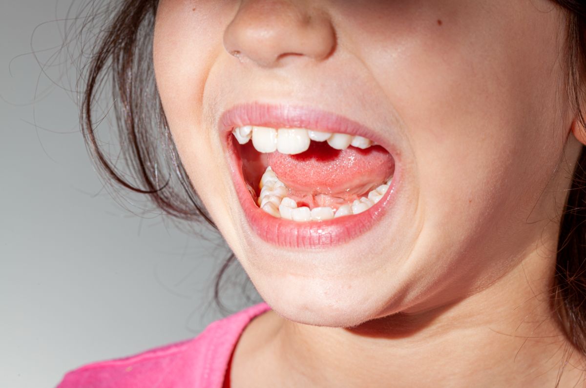 How To Fix Your Bite With Orthodontics