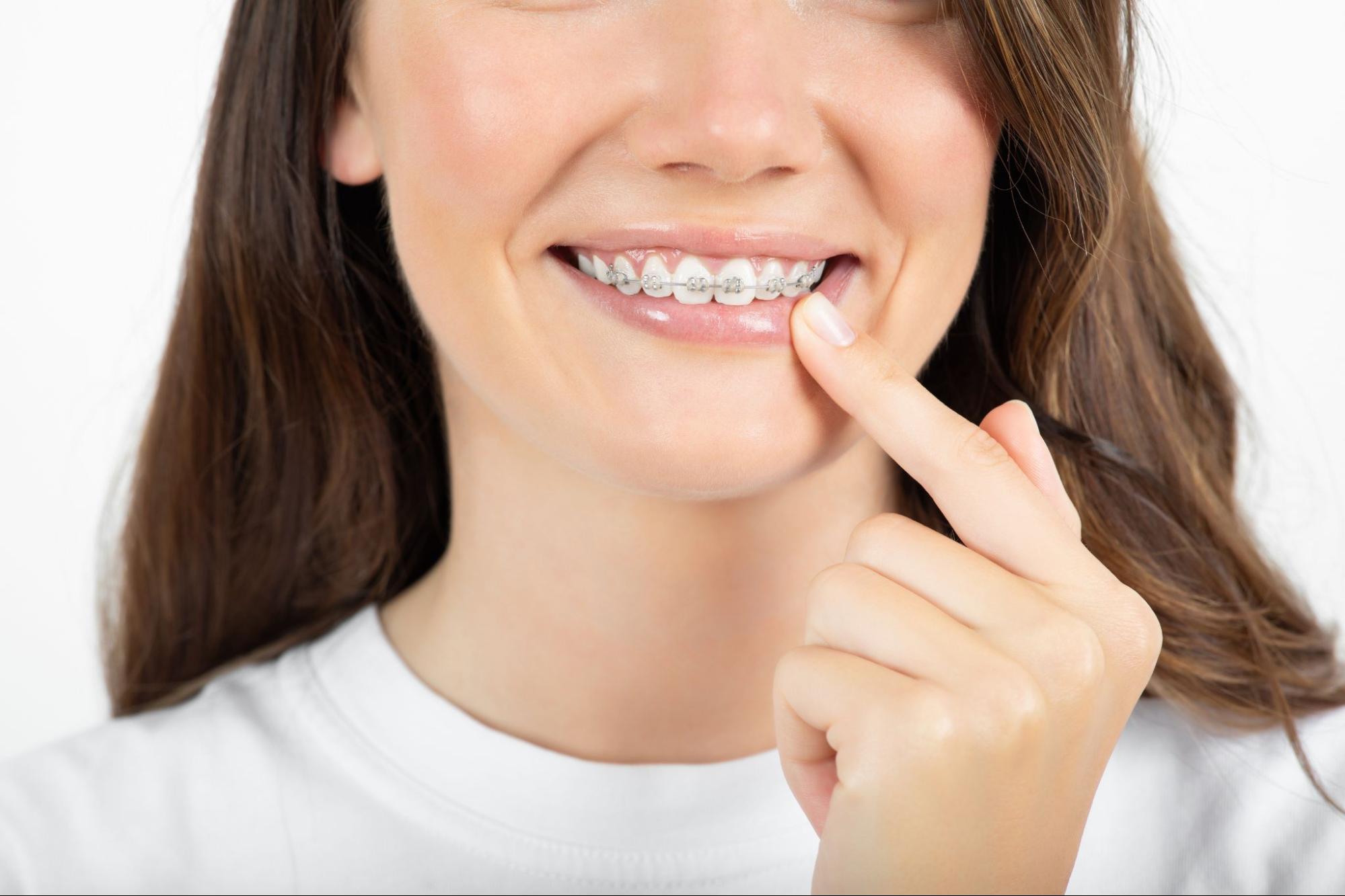 How Can I Prevent Tooth and Gum Issues While Wearing Braces?